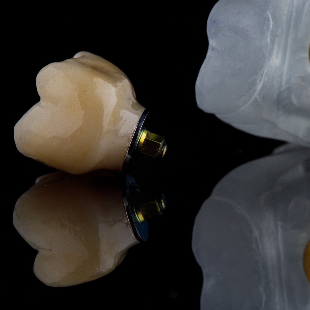 CAD/CAM Dentistry - GreenEwe Dental